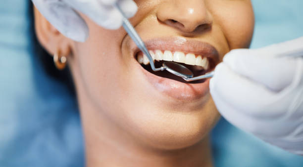 Best Emergency Denture Repair in Mill Creek, WA